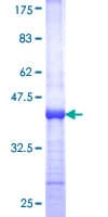 Human TINF2 Protein (Recombinant GST, N-terminus)