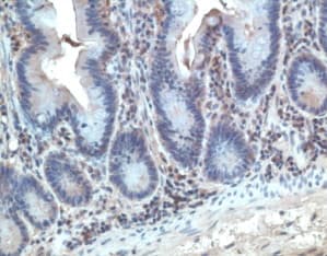 CCR10 / GPR2 Antibody (aa9-31)