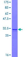 Human MAGEA1 / MAGE 1 Protein (Recombinant GST, N-terminus)