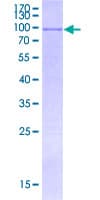 Human CDR2L Protein (Recombinant GST)