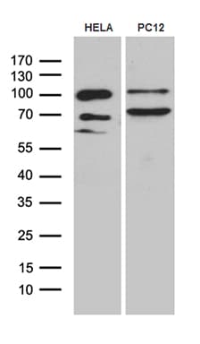 Monoclonal Mouse anti-Human PGM2L1 Antibody (clone OTI2D12, WB)