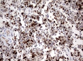 MKI67 / Ki67 Antibody (aa1160-1493, clone OTI5E6)