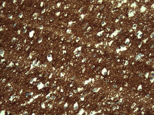 Monoclonal Mouse anti-Human NCAM / CD56 Antibody (clone UMAB194, Carrier-free, aa20-718, IHC, WB)