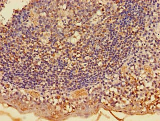 IHC-plus™ FKBP38 / FKBP8 Antibody