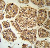 BLNK Antibody (aa150-178)