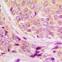 CCNB1 / Cyclin B1 Antibody (phospho-Ser147)