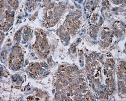 NPR3 Antibody (clone OTI11A6)