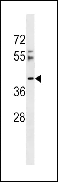 RSRC2 Antibody (aa8-37)