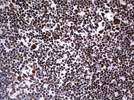 HNRPM / HNRNPM Antibody (aa1-261, clone OTI6H7)