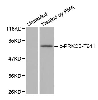 PRKCB / PKC-Beta Antibody (phospho-Thr641)