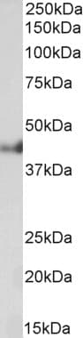 PathPlus™ KRT18 / CK18 / Cytokeratin 18 Antibody (aa200-300)