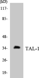 IHC-plus™ Polyclonal Rabbit anti-Human TAL1 Antibody (aa67-116, IHC, WB)