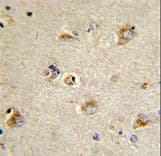 CDCA3 Antibody (aa41-69)