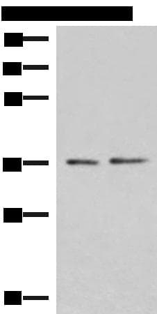 POLR3F Antibody
