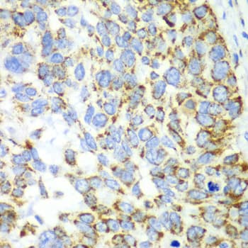 Polyclonal Rabbit anti-Human CHIA / Amcase Antibody (IHC, WB)