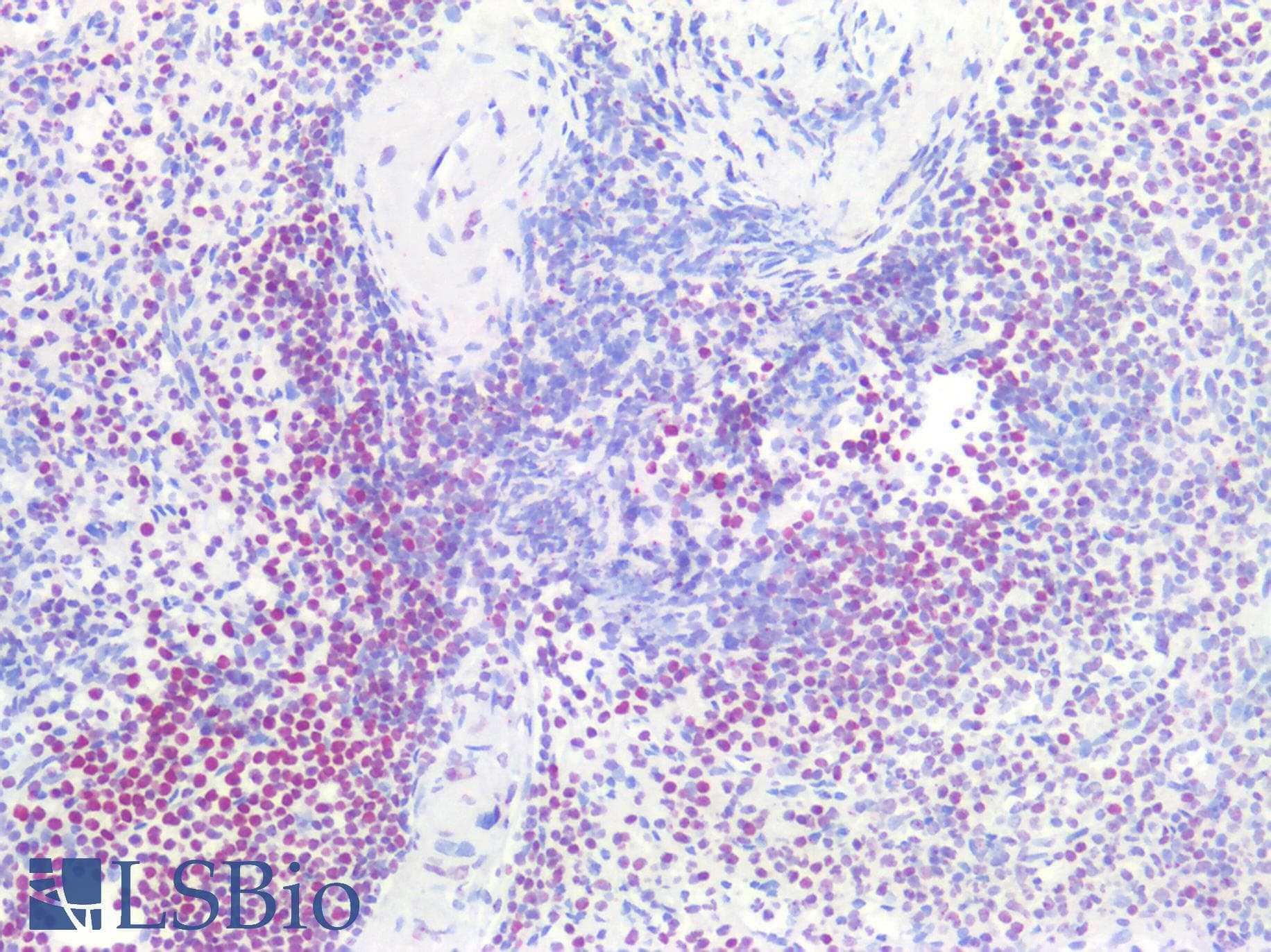 PathPlus™ SMN1 Antibody (aa50-100)