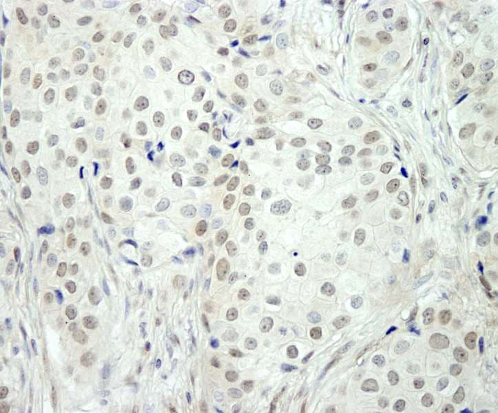 NCOA5 Antibody (aa525-C-term)