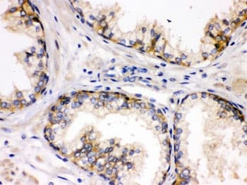 DLG1 / SAP97 Antibody