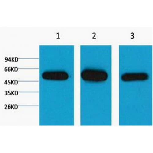 IHC-plus™ TUBB1 / Tubulin Beta 1 Antibody (clone 3F7)