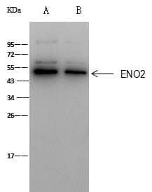 ENO2 / NSE Antibody (Preservative Free)