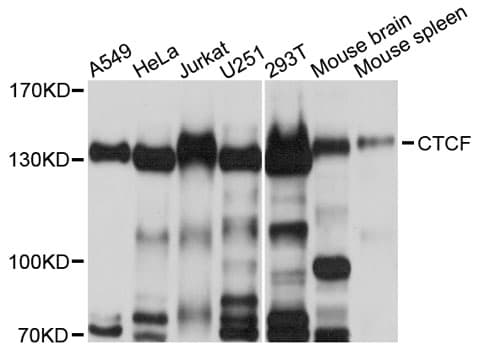 Polyclonal Rabbit anti-Human CTCF Antibody (IHC, IF, WB)