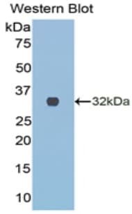 COL3A1 / Collagen III Antibody (aa1171-1435)