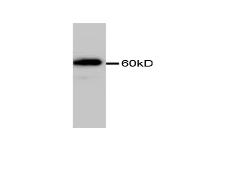 PathPlus™ ENO1 / Alpha Enolase Antibody (clone 12)