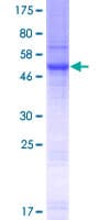 Human SLC35E2 Protein (Recombinant GST)