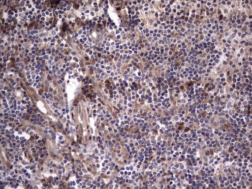 Monoclonal Mouse anti-Human MDM2 Antibody (clone OTI15F3, aa119-438, IHC, WB)