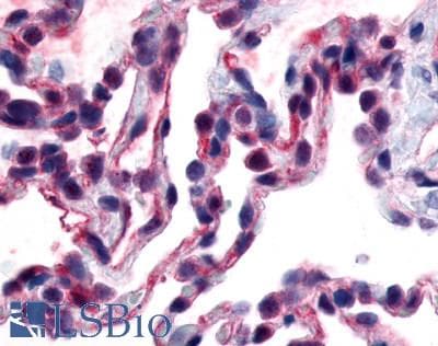 PathPlus™ Polyclonal Rabbit anti-Human CALCRL / CGRP Receptor Antibody (N-Terminus, IHC)