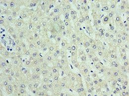 C14orf166 Antibody (aa1-244)