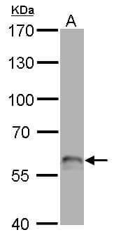 TP63 / p63 Antibody (aa125-415)