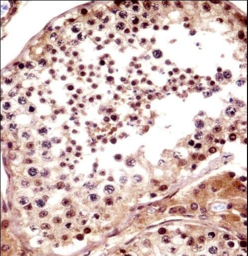 TNKS / Tankyrase Antibody (aa55-82)