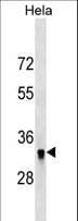 Polyclonal Rabbit anti-Human HIBADH Antibody (aa1-30, WB)