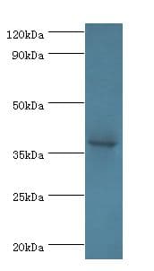 ATP6AP2 / Renin Receptor Antibody (aa1-176, HRP)