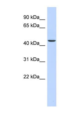 OGDH Antibody (N-Terminus)