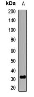 NTF3 / Neurotrophin 3 Antibody