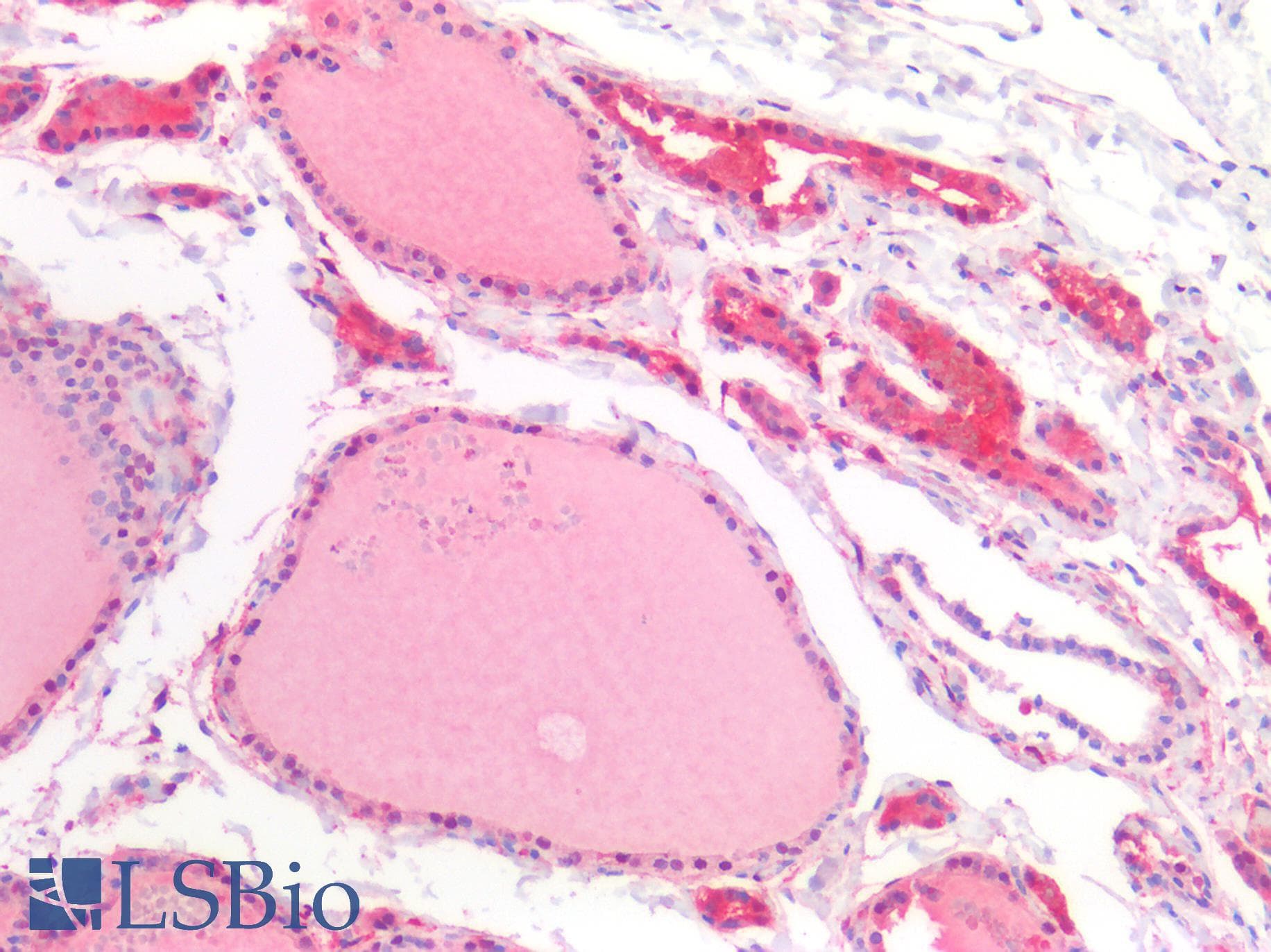 PathPlus™ ALDH1A1 / ALDH1 Antibody