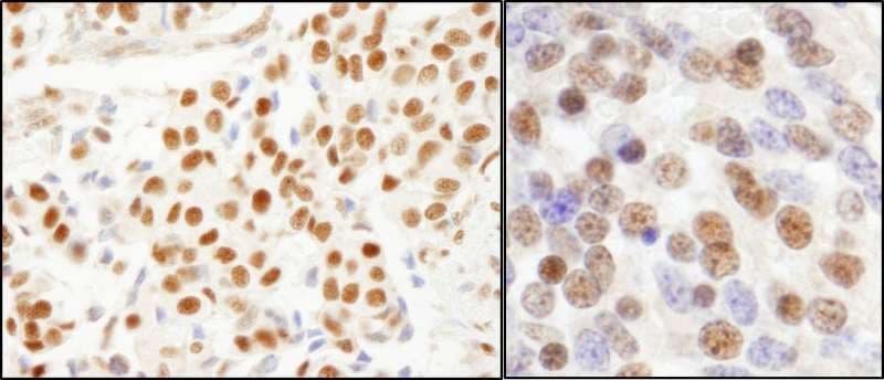 Polyclonal Rabbit anti-Human SF3A1 / SF3A120 Antibody (aa300-350, IHC, WB)