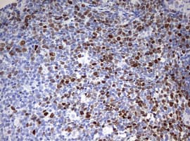 TOP2A / Topoisomerase II Alpha Antibody (aa1100-1531, clone OTI1D5)