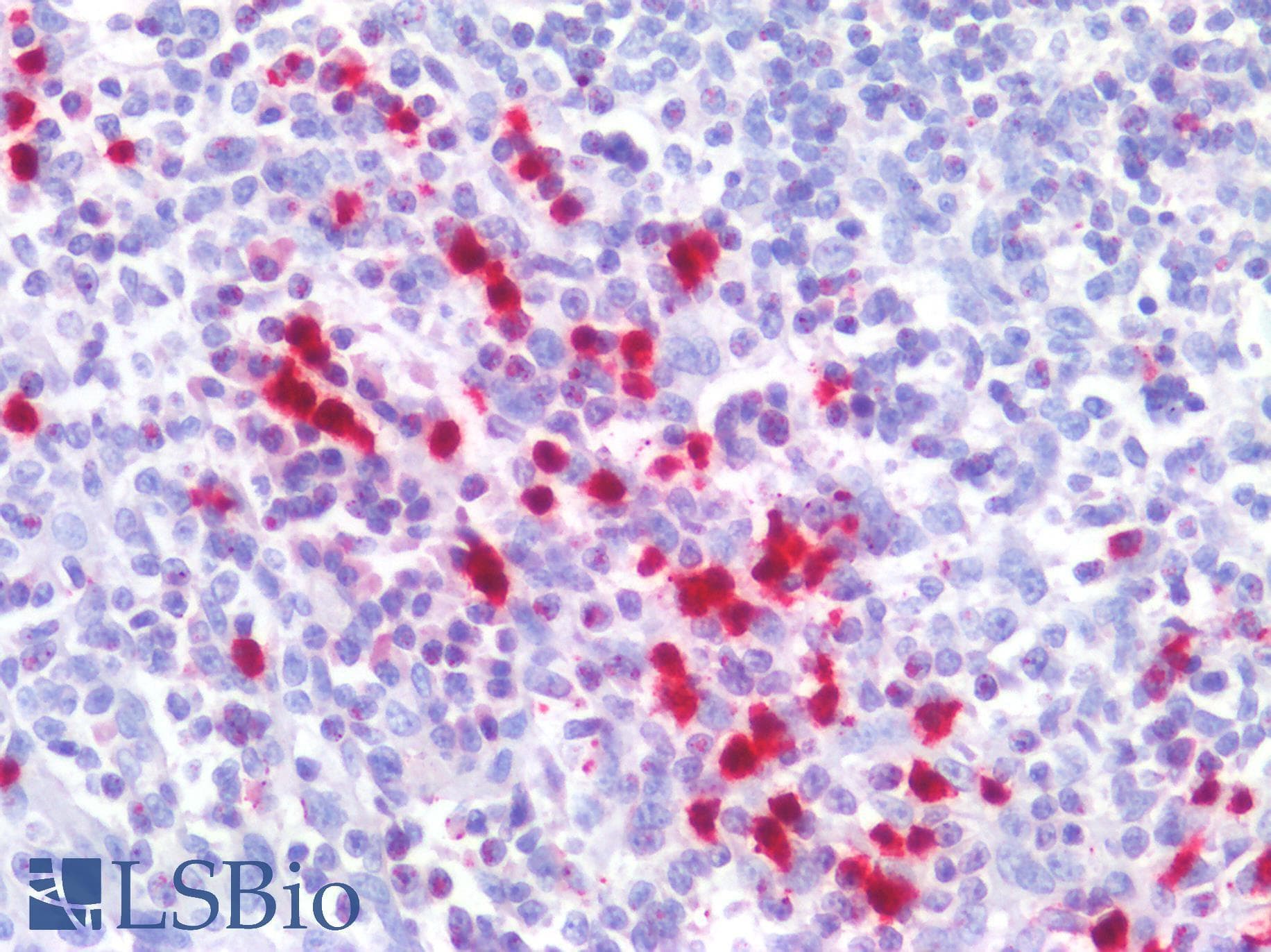 PathPlus™ GZMB / Granzyme B Antibody (N-Terminus)