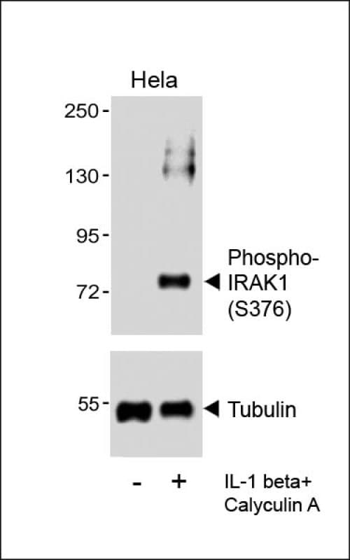 Polyclonal Rabbit anti-Human IRAK1 / IRAK Antibody (phospho-Ser376, IHC, IF, WB)