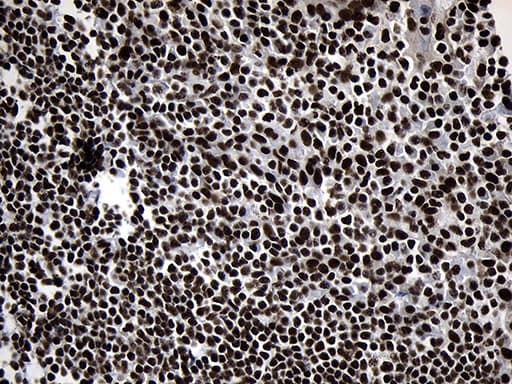 POLR2A / RNA polymerase II Antibody (aa1351-1614, clone OTI2B7)