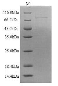 Mouse CBLN3 / Cerebellin 3 Protein (Recombinant 6His, N-terminus)