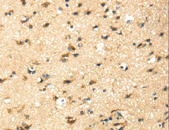 Polyclonal Rabbit anti-Human KRT17 / CK17 / Cytokeratin 17 Antibody (IHC)