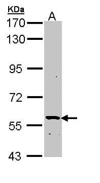 IHC-plus™ Polyclonal Rabbit anti-Human PLA2G3 Antibody (Internal, IHC, WB)