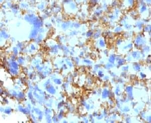 IHC-plus™ HLA-DRB1 Antibody (clone LN3)