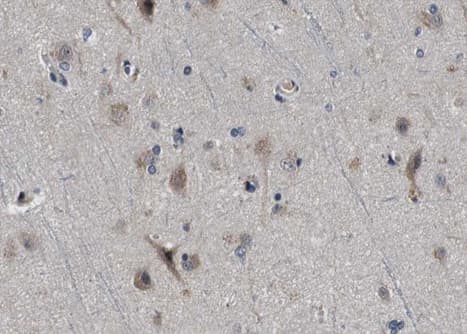 CPT1C Antibody