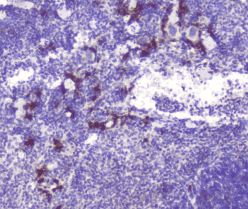 RASAL1 / RASAL Antibody