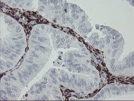 F13A1 / Factor XIIIa Antibody (clone OTI3F1)